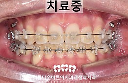 수술후