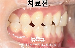 수술전