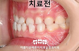 수술전
