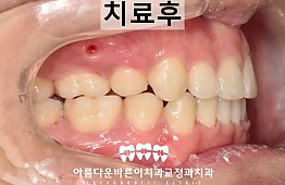 수술후