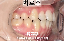 수술후