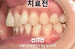 수술전