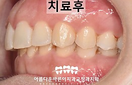 수술후