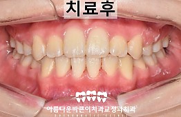 수술후