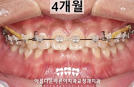 수술후