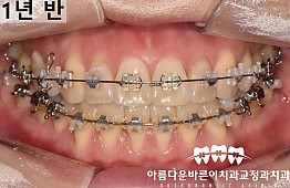 수술후