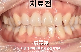 수술전