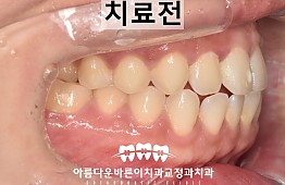 수술전