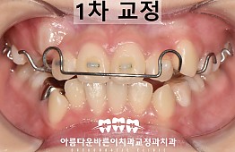 수술후