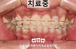 수술후