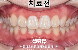 수술전