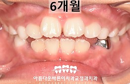 수술후