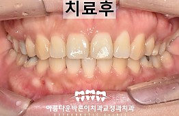 수술후