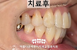 수술후