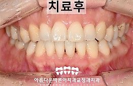 수술후