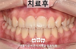 수술후