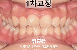 수술후