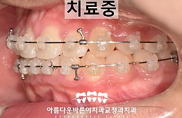 수술후