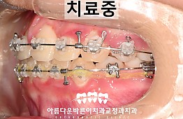 수술후