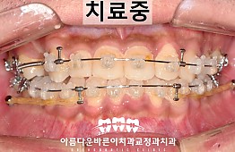 수술후