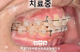 수술후