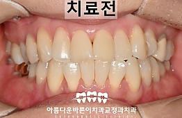 수술전