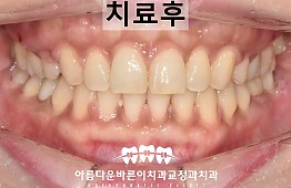 수술후