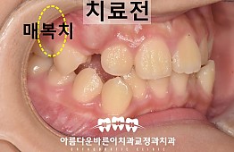 수술전