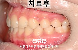 수술후