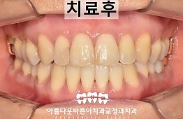 수술후