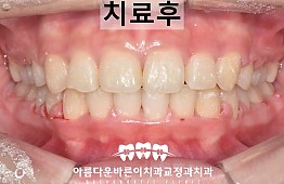 수술후