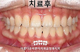 수술후