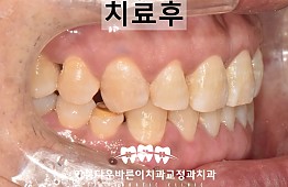 수술후