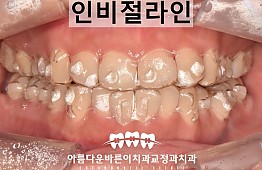 수술후