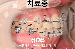 수술후