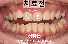 수술전