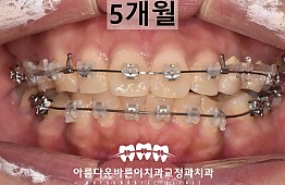 수술후