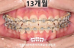 수술후