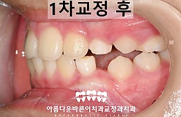 수술후