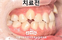 수술전