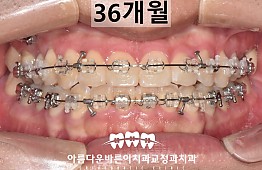 수술후