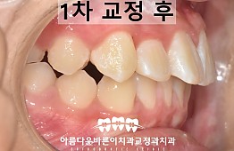 수술후