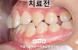 수술전