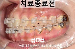 수술후