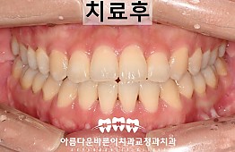 수술후