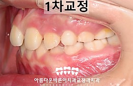 수술후