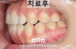 수술후