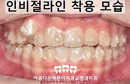 수술후