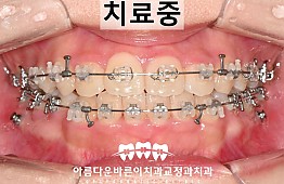 수술후