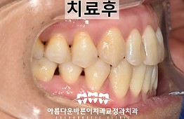 수술후
